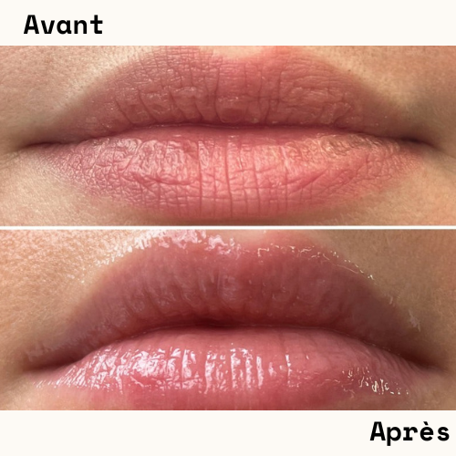 Repulpeur de lèvres longue durée