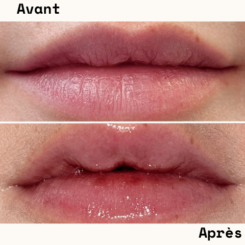 Repulpeur de lèvres longue durée