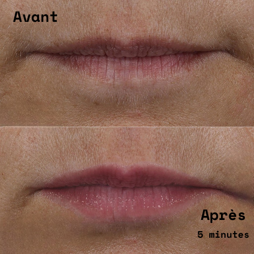 Répulpeur à lèvre extrème