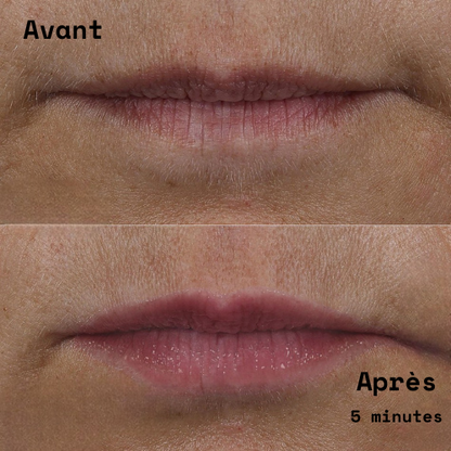 Répulpeur à lèvre extrème