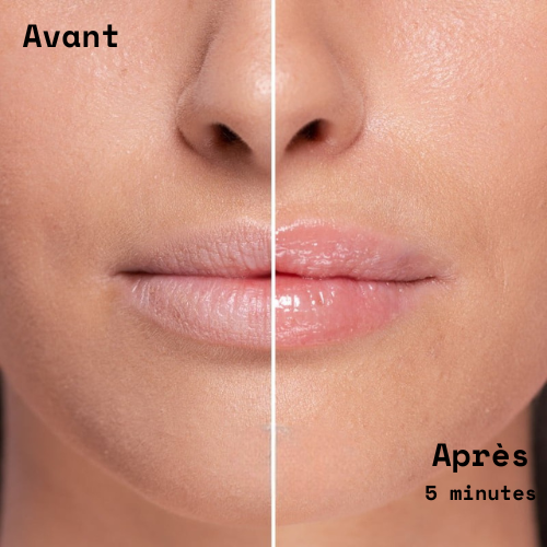 Répulpeur à lèvre extrème
