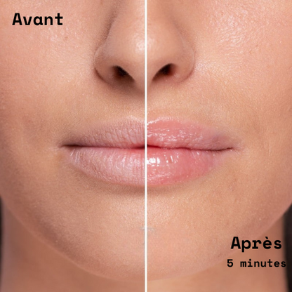 Répulpeur à lèvre extrème