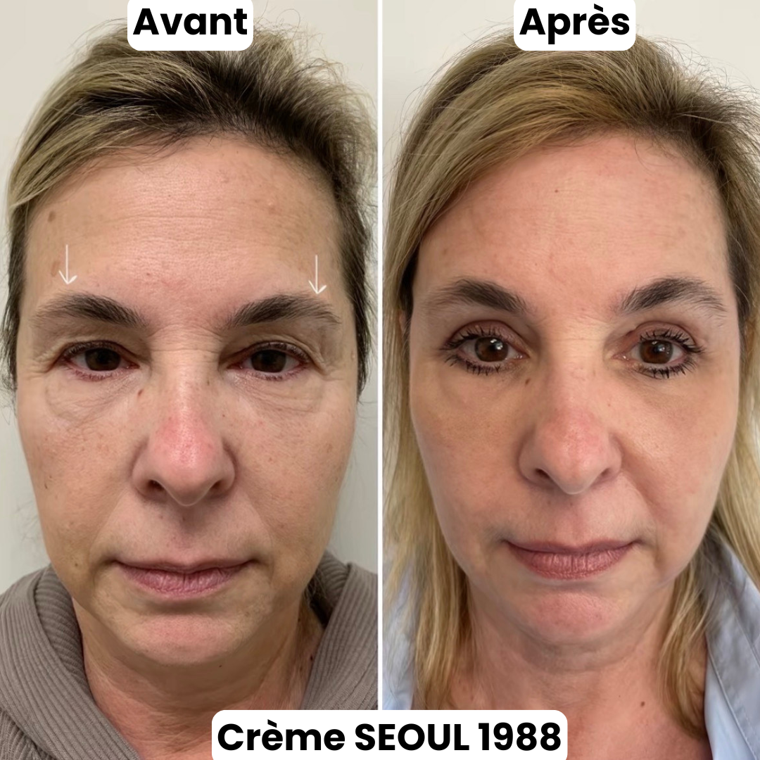 Crème Contour Yeux Séoul 1988
