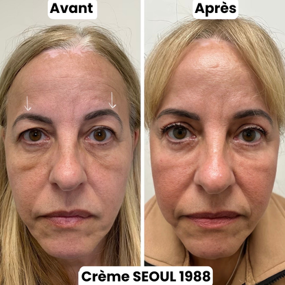 Crème Contour Yeux Séoul 1988