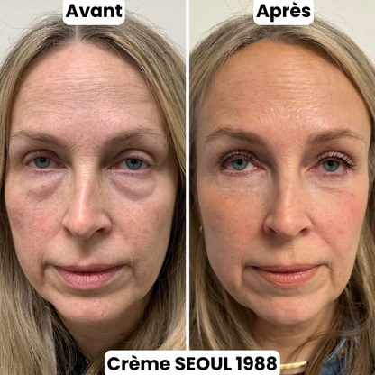 Crème Contour Yeux Séoul 1988