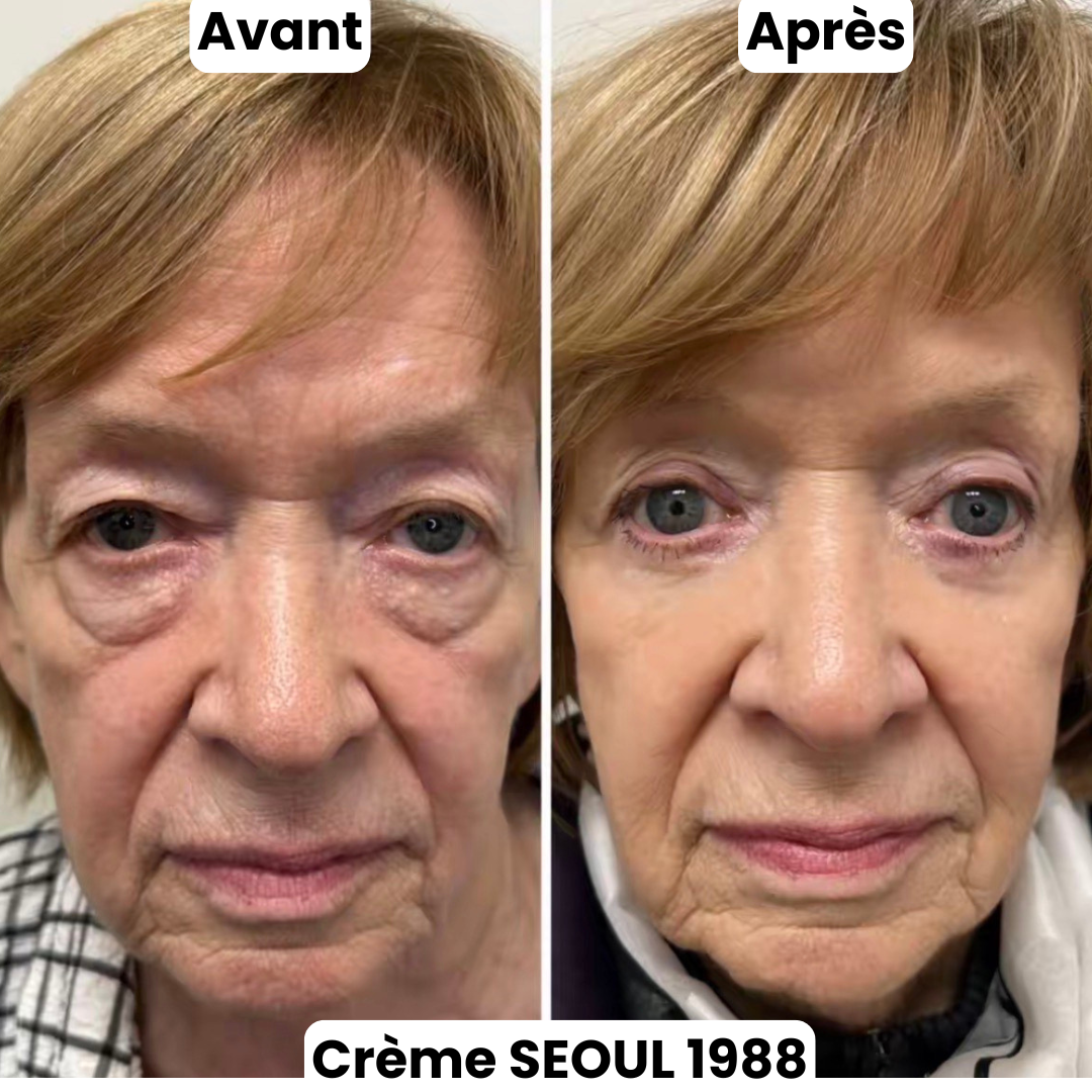 Crème Contour Yeux Séoul 1988