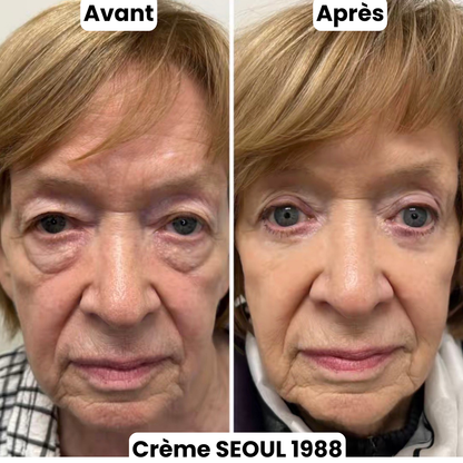 Crème Contour Yeux Séoul 1988