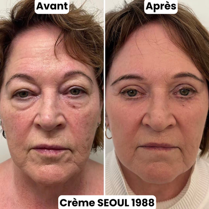 Crème Contour Yeux Séoul 1988